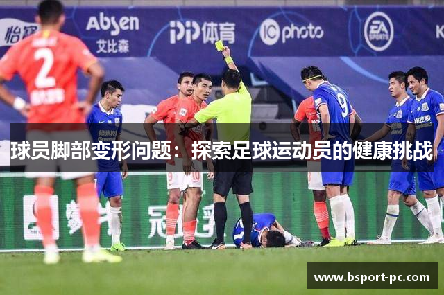 球员脚部变形问题：探索足球运动员的健康挑战